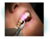 Dentallaser (schmerzfreies Bohren)